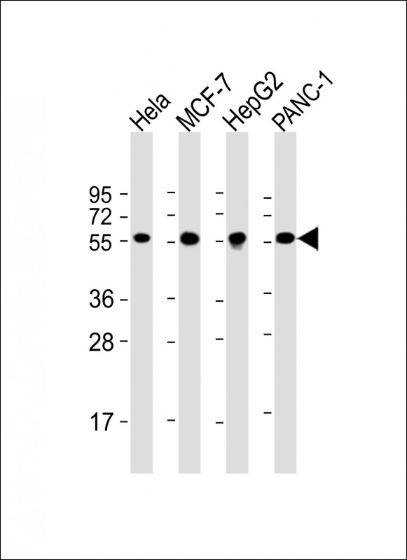 m02335 1 anti pdia1 antibody wb testing 1