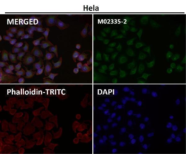 Immunofluorescent analysis using the Antibody at 1:50 dilution