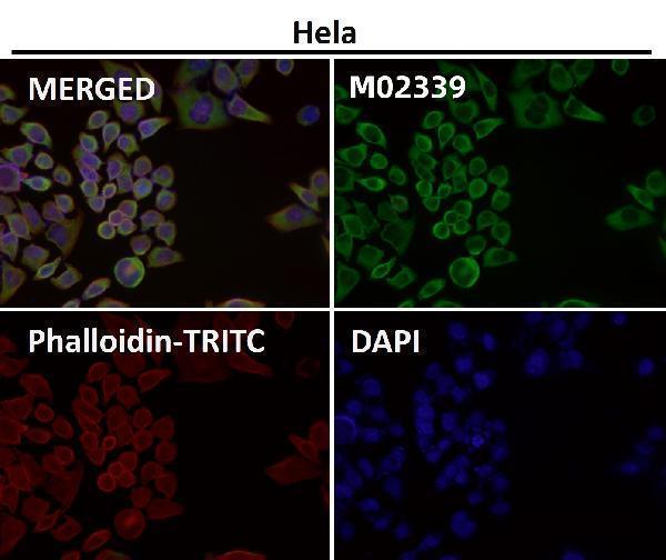 Immunofluorescent analysis using the Antibody at 1:50 dilution