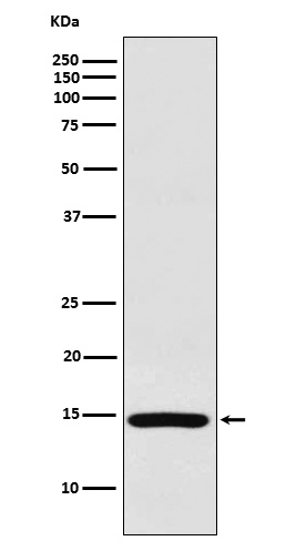 Western blot analysis of RPS19 expression in HeLa cell lysate