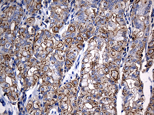 m02344 anti myo18a mouse monoclonal antibody clone id oti3f7 ihc testing 2