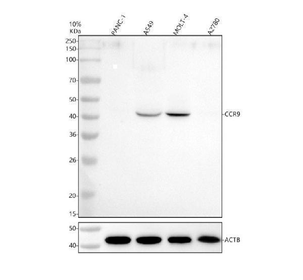 Western blot analysis of CCR9 using anti-CCR9 antibody (M02348)
