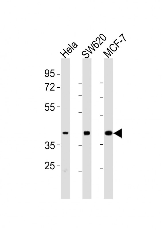 m02350 anti hpn antibody center wb testing 2
