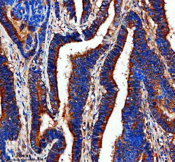 m02352 6 calca primary antibodies ihc testing 1