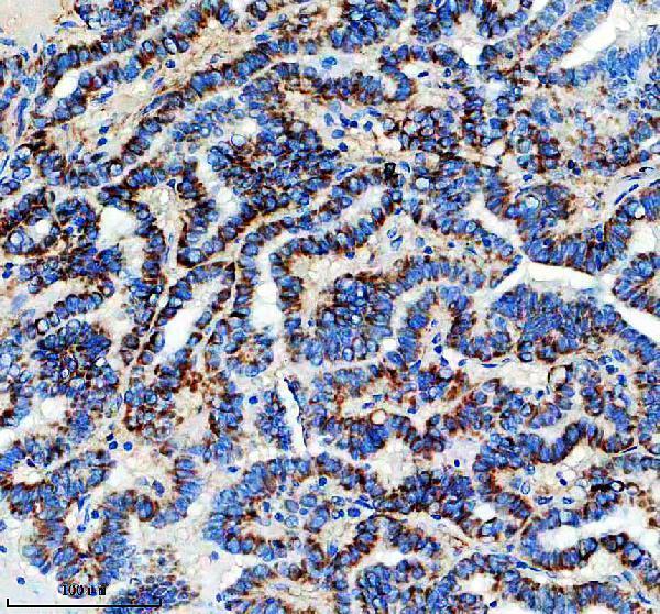 m02352 6 calca primary antibodies ihc testing 2