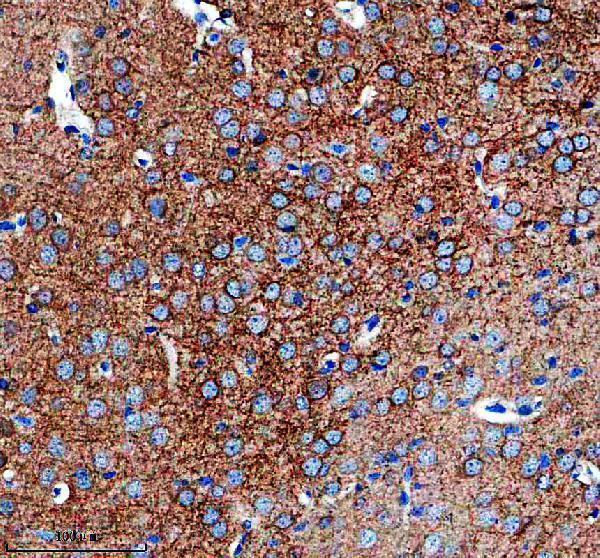 m02352 6 calca primary antibodies ihc testing 3