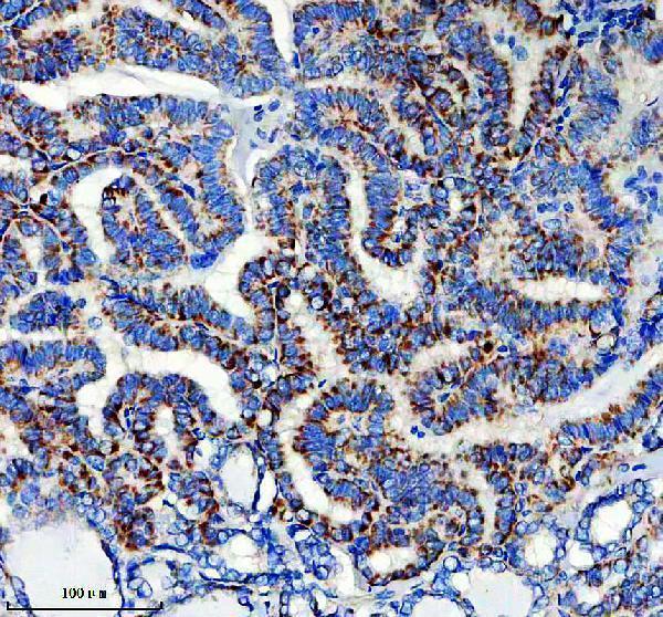 m02352 6 calca primary antibodies ihc testing 5