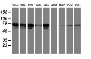 m02353 anti transferrin receptor 2 tfr2 mouse monoclonal antibody clone id oti2b4 wb testing 2