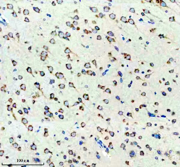 m02354 map3k2 primary antibodies ihc testing 1