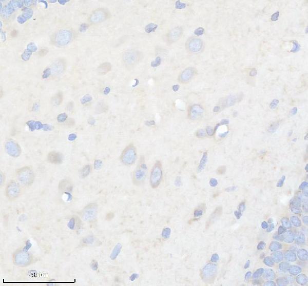 m02355 gdf11 primary antibodies ihc testing 3