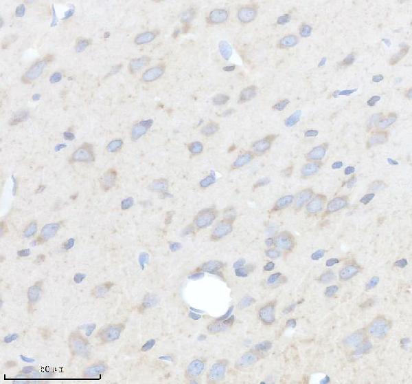m02355 gdf11 primary antibodies ihc testing 4