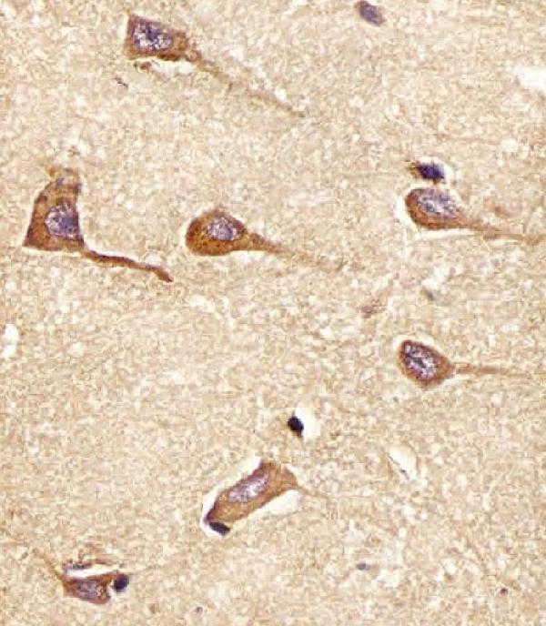 m02364 anti amph antibody center ihc p testing 2
