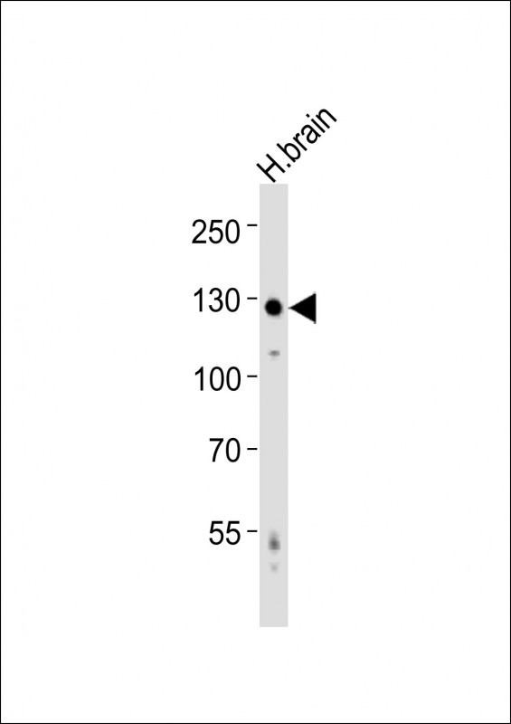 m02364 anti amph antibody center wb testing 1