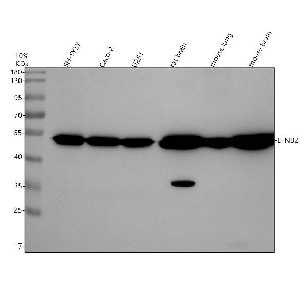 m02368 1 efnb2 primary antibodies wb testing 1