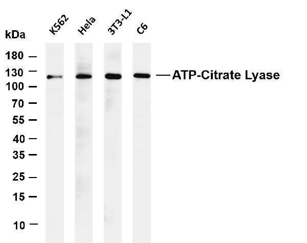 Various whole cell lysates were separated by 4-20% SDS-PAGE, and the membrane was blotted with anti-ATP-Citrate Lyase antibody