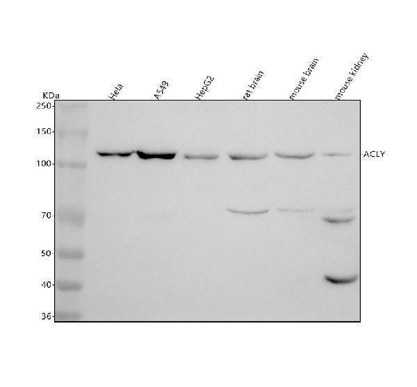  Western blot analysis of ACLY using anti-ACLY antibody (M02372)