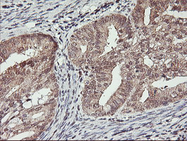 m02377 anti hlcs mouse monoclonal antibody clone id oti1e4 ihc testing 2