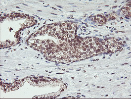 m02377 anti hlcs mouse monoclonal antibody clone id oti1e4 ihc testing 3