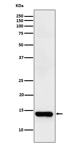 Western blot analysis of intestinal FABP expression in Human small intestine lysate
