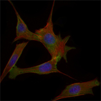 Immunofluorescent staining data of FABP2 using Anti-I-FABP FABP2 Monoclonal Antibody (M02378)