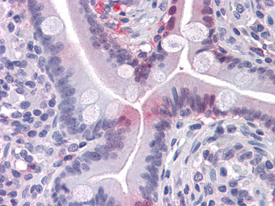 Immunohistochemistry validation of FABP2 using Anti-I-FABP FABP2 Monoclonal Antibody (M02378)