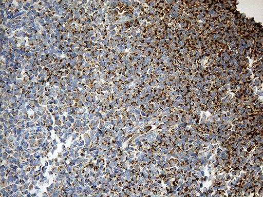 Immunohistochemical staining of paraffin-embedded Human tonsil within the normal limits using anti-ACADM mouse monoclonal antibody