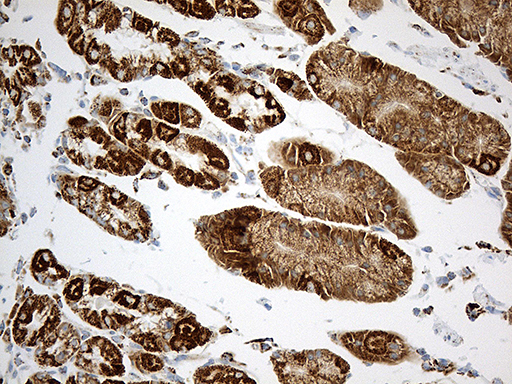 m02383 1 anti acadm mouse monoclonal antibody clone id oti2g7 ihc testing 5