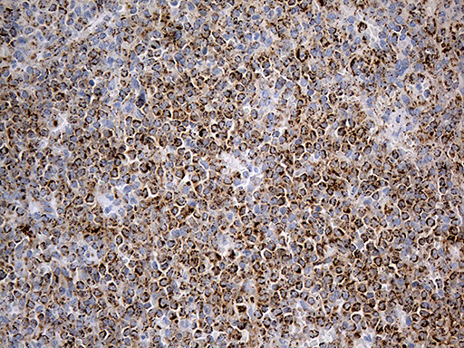 m02383 1 anti acadm mouse monoclonal antibody clone id oti2g7 ihc testing 6