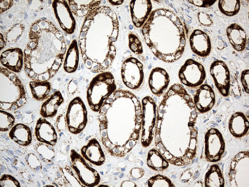 m02383 1 anti acadm mouse monoclonal antibody clone id oti2g7 ihc testing 7