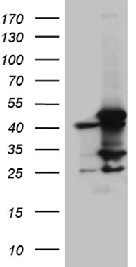 m02383 1 anti acadm mouse monoclonal antibody clone id oti2g7 wb testing 1
