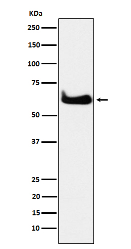 Western blot analysis of TCP1 alpha expression in HeLa cell lysate