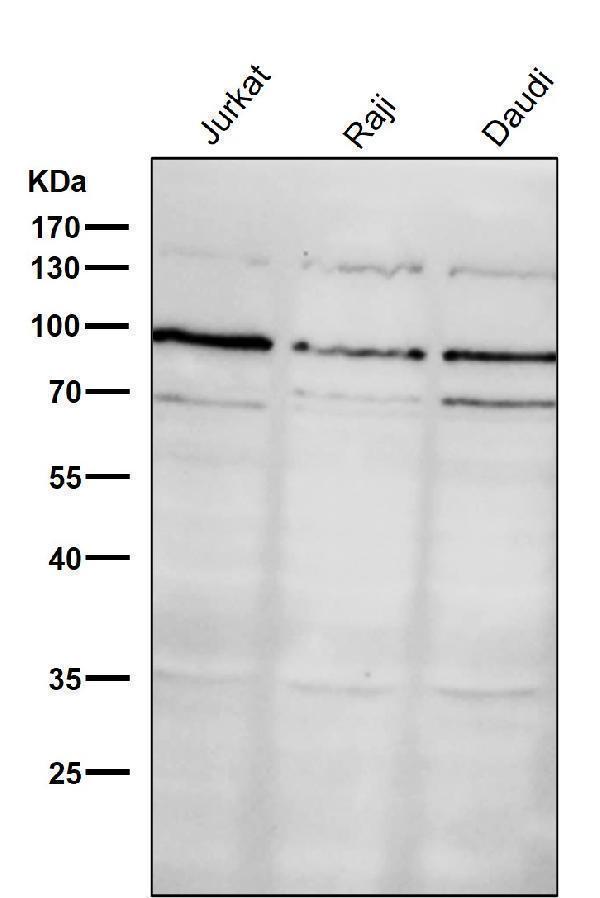 All lanes use the Antibody at 1:1K dilution for 1 hour at room temperature