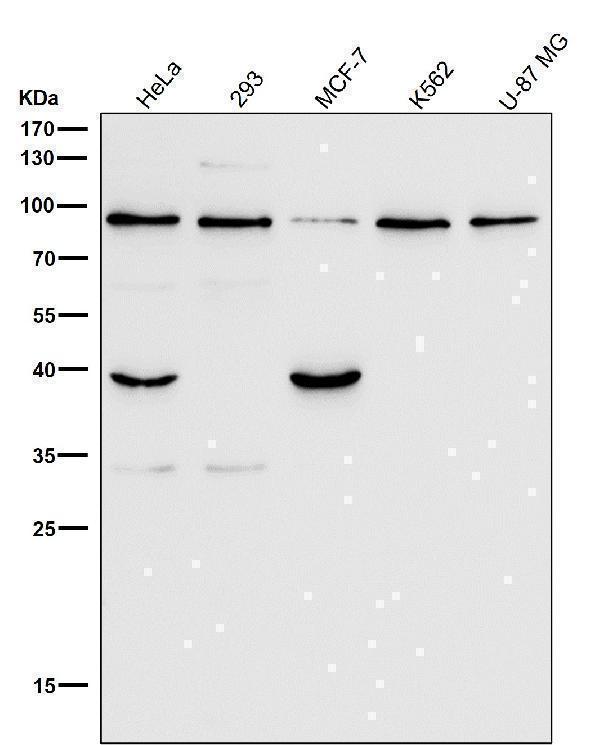 All lanes use the Antibody at 1:1K dilution for 1 hour at room temperature