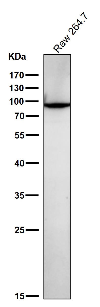 All lanes use the Antibody at 1:1K dilution for 1 hour at room temperature