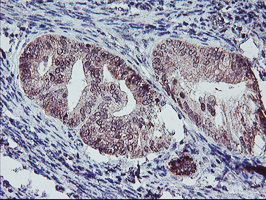 m02394 anti gadd34 ppp1r15a mouse monoclonal antibody clone id oti3d12 ihc testing 5