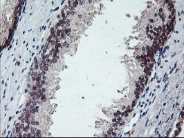 m02394 anti gadd34 ppp1r15a mouse monoclonal antibody clone id oti3d12 ihc testing 6