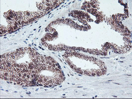 m02394 anti gadd34 ppp1r15a mouse monoclonal antibody clone id oti3d12 ihc testing 7