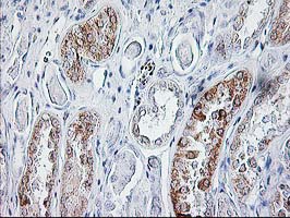 m02395 1 anti sirt5 mouse monoclonal antibody clone id oti2f1 ihc testing 4