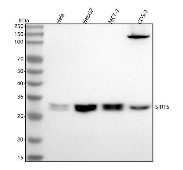 Western blot analysis of SIRT5 using anti-SIRT5 antibody (M02395-1)