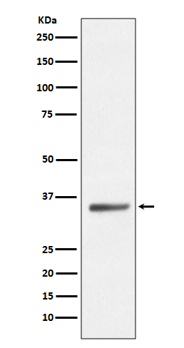 Western blot analysis of SIRT5 expression in HeLa cell lysate