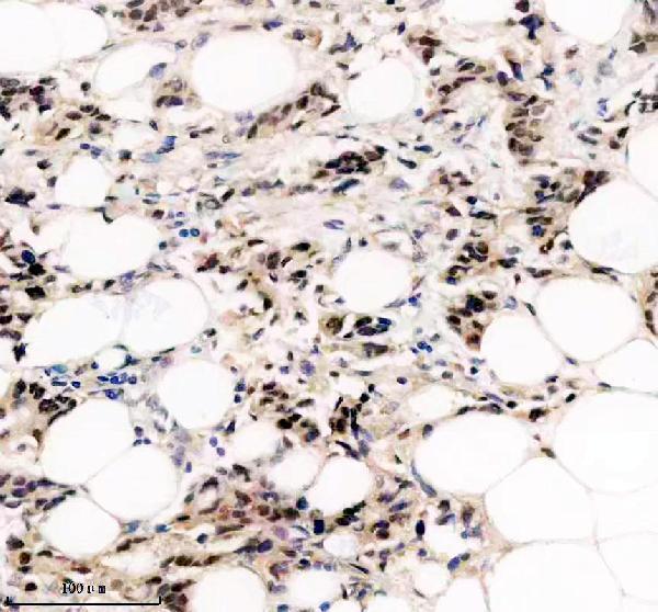 m02398 csnk2a1 primary antibodies ihc testing 1