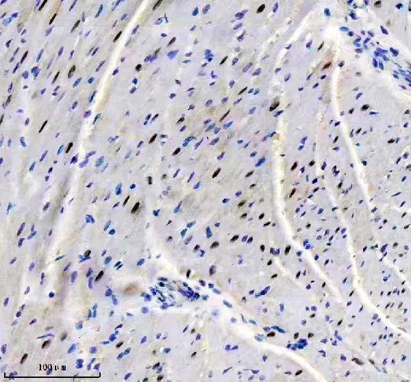 m02398 csnk2a1 primary antibodies ihc testing 2