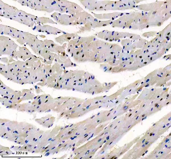m02398 csnk2a1 primary antibodies ihc testing 3
