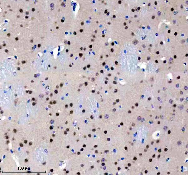m02398 csnk2a1 primary antibodies ihc testing 4