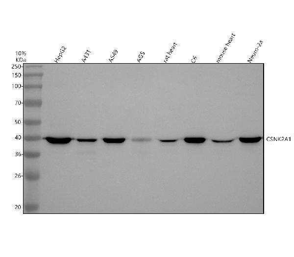 m02398 csnk2a1 primary antibodies wb testing 1