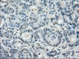 m02399 2 anti leukotriene a4 hydrolase lta4h mouse monoclonal antibody clone id oti1e9 ihc testing 11