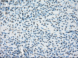 m02399 2 anti leukotriene a4 hydrolase lta4h mouse monoclonal antibody clone id oti1e9 ihc testing 7