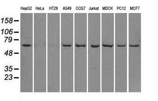 m02399 2 anti leukotriene a4 hydrolase lta4h mouse monoclonal antibody clone id oti1e9 wb testing 2