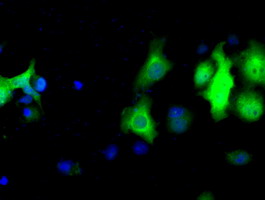 m02399 anti leukotriene a4 hydrolase lta4h mouse monoclonal antibody clone id oti7d11 if testing 18