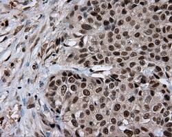 m02399 anti leukotriene a4 hydrolase lta4h mouse monoclonal antibody clone id oti7d11 ihc testing 10